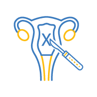 Hysterectomy