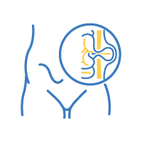 Incisional hernia