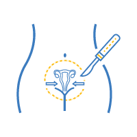 Vaginoplasty